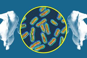 Salmonella bacteria in a photo composite with two raw chickens. 